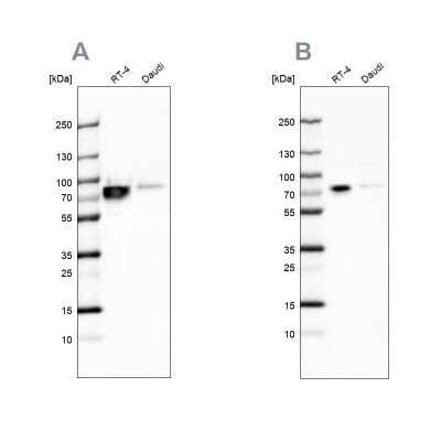 Western Blot: DDX3 Antibody [NBP1-85291]