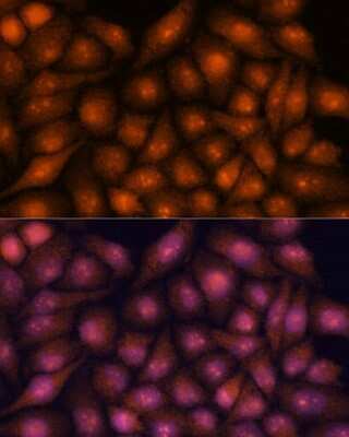 Immunocytochemistry/ Immunofluorescence: DDX31 Antibody - Azide and BSA Free [NBP2-92273]