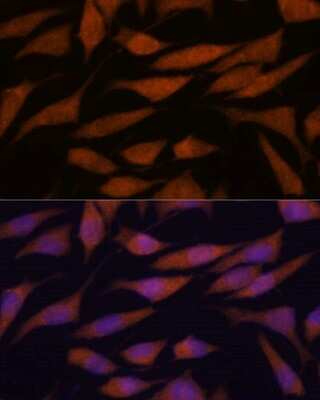 Immunocytochemistry/ Immunofluorescence: DDX31 Antibody - Azide and BSA Free [NBP2-92273]