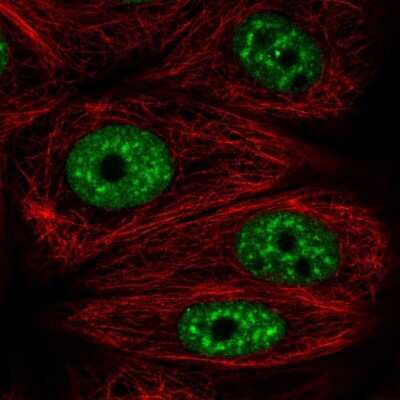 Immunocytochemistry/ Immunofluorescence: UAP56 Antibody [NBP2-46824]