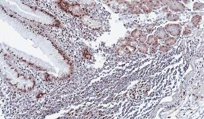 Immunohistochemistry-Paraffin: DDX39 Antibody [NBP1-31407]