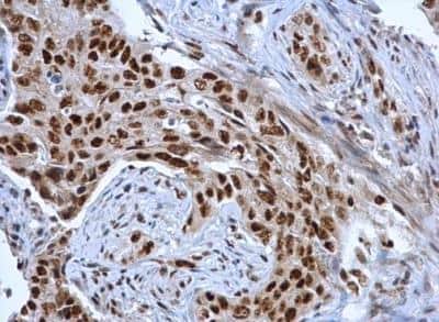 Immunohistochemistry-Paraffin: DDX39 Antibody [NBP2-16134]