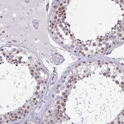 Immunohistochemistry-Paraffin: UAP56 Antibody [NBP2-46824]