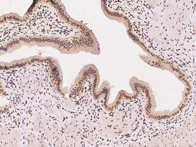Immunohistochemistry-Paraffin: DDX39 Antibody [NBP2-98622]