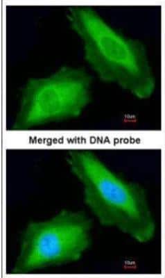 Immunocytochemistry/ Immunofluorescence: DDX3 Antibody [NBP1-32780]