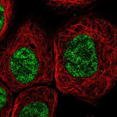 Immunocytochemistry/ Immunofluorescence: DDX41 Antibody [NBP1-89297]