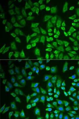 Immunocytochemistry/ Immunofluorescence: DDX41 Antibody - BSA Free [NBP2-92929]