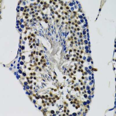 Immunohistochemistry-Paraffin: DDX41 Antibody - BSA Free [NBP2-92929]