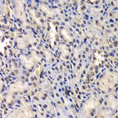 Immunohistochemistry-Paraffin: DDX41 Antibody - BSA Free [NBP2-92929]