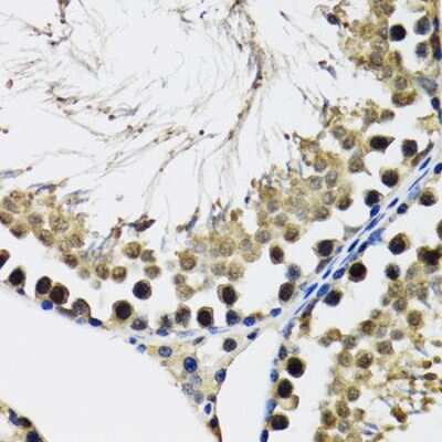 Immunohistochemistry-Paraffin: DDX41 Antibody - BSA Free [NBP2-92929]
