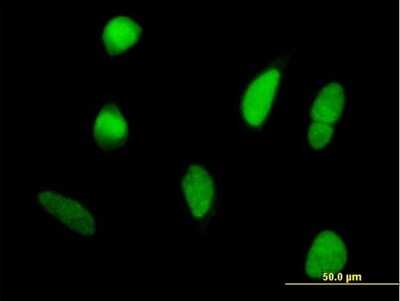 Immunocytochemistry/ Immunofluorescence: DDX42 Antibody [H00011325-B01P]