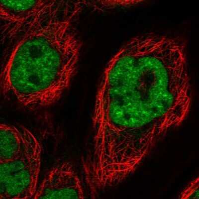 Immunocytochemistry/ Immunofluorescence: DDX42 Antibody [NBP1-87135]