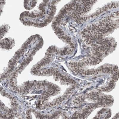 Immunohistochemistry-Paraffin: DDX42 Antibody [NBP1-87135]