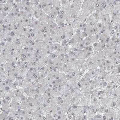 Immunohistochemistry-Paraffin: DDX42 Antibody [NBP1-87135]