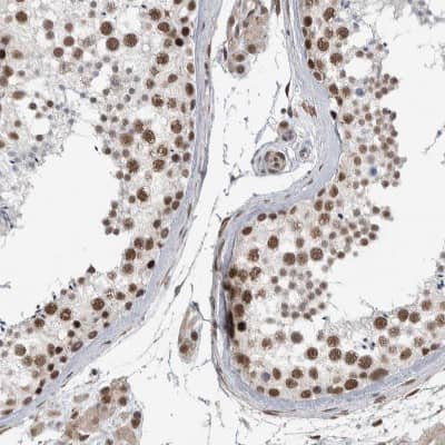 Immunohistochemistry-Paraffin: DDX42 Antibody [NBP1-87135]