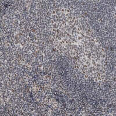 Immunohistochemistry-Paraffin: DDX42 Antibody [NBP1-87135]