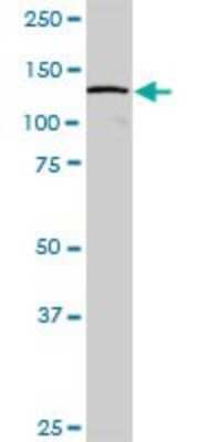 Western Blot: DDX42 Antibody [H00011325-B01P]
