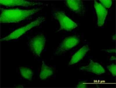 Immunocytochemistry/ Immunofluorescence: DDX43 Antibody (3G12) [H00055510-M07]