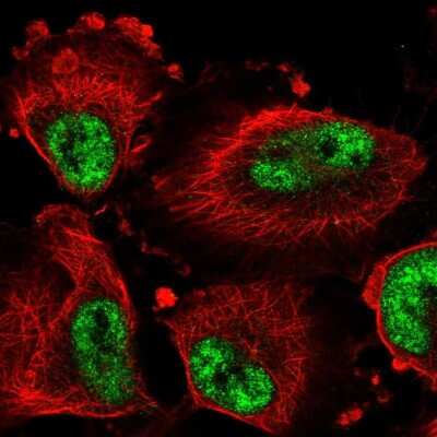 Immunocytochemistry/ Immunofluorescence: DDX46 Antibody [NBP2-56227]