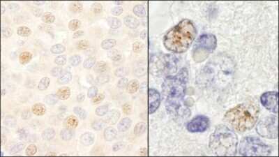 Immunohistochemistry-Paraffin: DDX46 Antibody [NB100-57490]