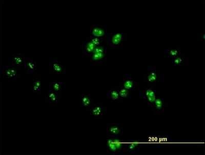 Immunocytochemistry/ Immunofluorescence: DDX47 Antibody [H00051202-B01P]