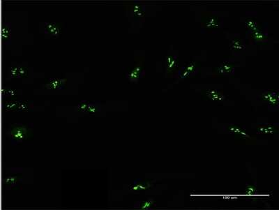 Immunocytochemistry/ Immunofluorescence: DDX47 Antibody [H00051202-B02P]