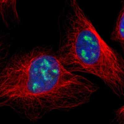 Immunocytochemistry/ Immunofluorescence: DDX47 Antibody [NBP1-85076]