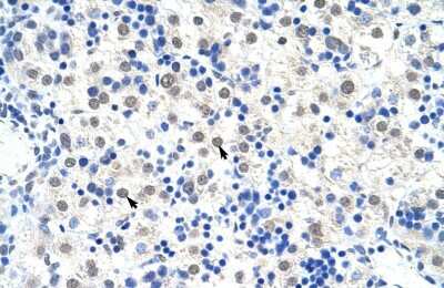Immunohistochemistry-Paraffin: DDX47 Antibody [NBP1-57295]