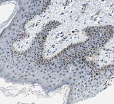 Immunohistochemistry-Paraffin: DDX47 Antibody [NBP1-85076]