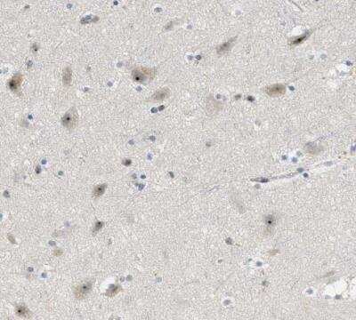 Immunohistochemistry-Paraffin: DDX47 Antibody [NBP1-85076]