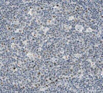Immunohistochemistry-Paraffin: DDX47 Antibody [NBP1-85076]