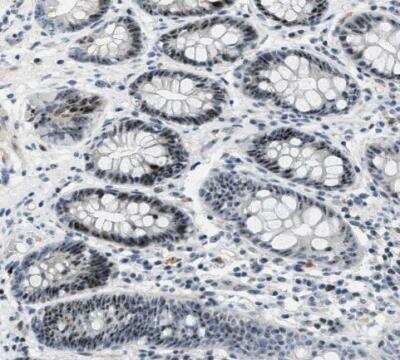 Immunohistochemistry-Paraffin: DDX47 Antibody [NBP1-85076]