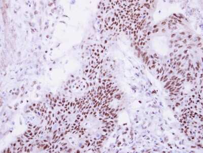 Immunohistochemistry-Paraffin: DDX47 Antibody [NBP2-16139]
