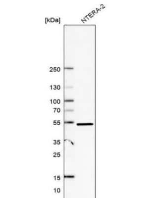 Western Blot: DDX47 Antibody [NBP1-85076]