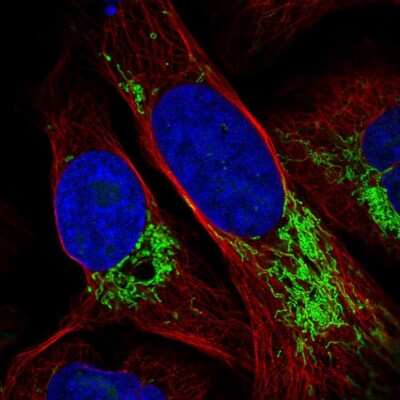 Immunocytochemistry/ Immunofluorescence: DDX49 Antibody [NBP2-47491]