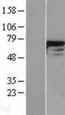 Western Blot: DDX5 Overexpression Lysate [NBL1-09801]