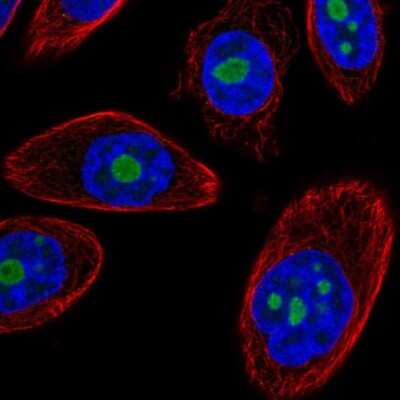 Immunocytochemistry/ Immunofluorescence: DDX50 Antibody [NBP2-58135]