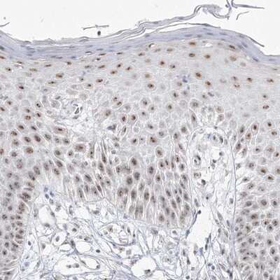 Immunohistochemistry-Paraffin: DDX50 Antibody [NBP1-83311]