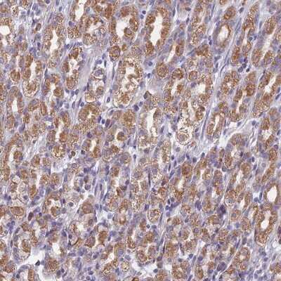 Immunohistochemistry-Paraffin: DDX51 Antibody [NBP1-85859]