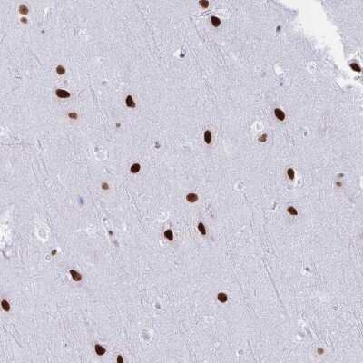 Immunohistochemistry-Paraffin: DDX52 Antibody [NBP2-33776]