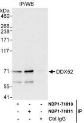 Immunoprecipitation: DDX52 Antibody [NBP1-71810]
