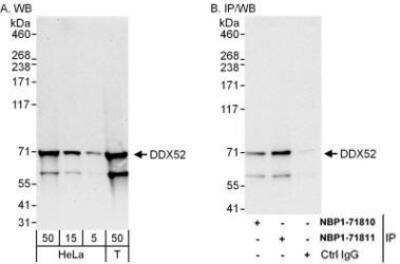 Western Blot: DDX52 Antibody [NBP1-71811]