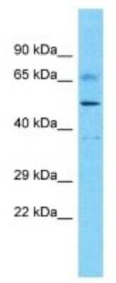 Western Blot: DDX52 Antibody [NBP3-10394]