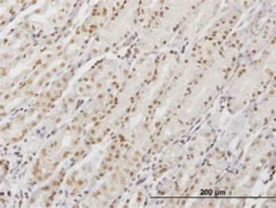 Immunohistochemistry-Paraffin: DDX54 Antibody (2E4) [H00079039-M02]