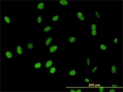 Immunocytochemistry/ Immunofluorescence: DDX54 Antibody (2H6) [H00079039-M01]