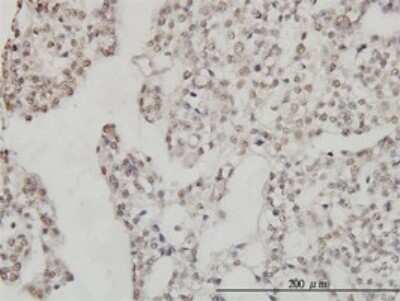 Immunohistochemistry-Paraffin: DDX54 Antibody (2H6) [H00079039-M01]