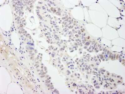 Immunohistochemistry-Paraffin: DDX54 Antibody [NB100-60677]
