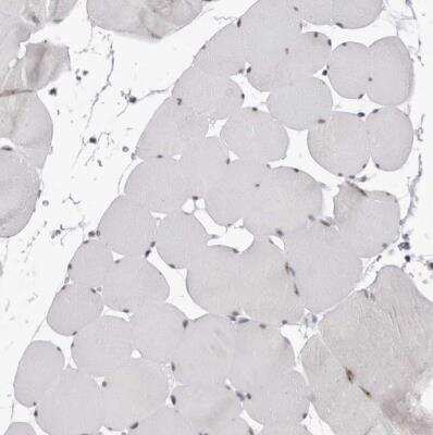 Immunohistochemistry-Paraffin: DDX54 Antibody [NBP1-89028]