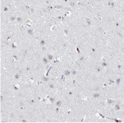 Immunohistochemistry-Paraffin: DDX54 Antibody [NBP1-89028]