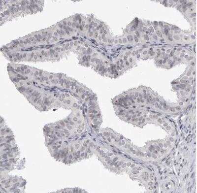 Immunohistochemistry-Paraffin: DDX54 Antibody [NBP1-89028]